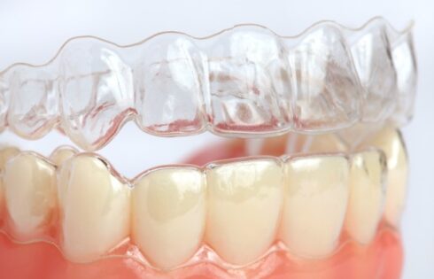 What to know about cosmetic dentistry